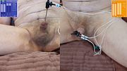 Rosebud sounding attached to my ESTIM Power Box