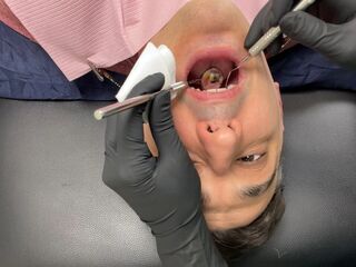 Nurse Bunny Checks Dr. Canada's Teeth Multi Angle