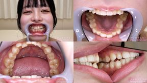 Wakaba Tsukimi - Watching Inside mouth of Japanese cute girl - 1080p