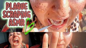 ASMR Dental Fun Taboo: Plaque Scraping, ASMR Teeth Cleaning in Sunlight | Natural Sounds + Up-Close Plaque Removal (BBW Freckled Goddess)