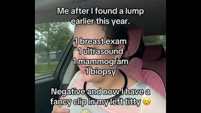 OhSo I never said anything on any platform until a few weeks ago on TT#boobs #breastcancer
