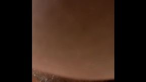 Tiny Teen Torn Open Anal👌 Creamy Orgasm💦