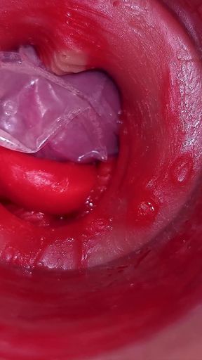 The Camera Inside the Deep Pussy Records a Huge Ejaculation with a Stuck Condom!