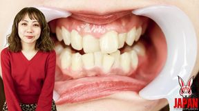 Inside RUMI's Mouth: Explore Her Dental Care Secrets!