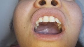 Open your mouth and do a gargle session! Ruuuu!