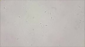 My fertile semen through a microscope