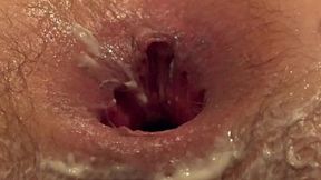 Lesbian lust fest: fatty fingers fatten her friend's ass&#x1F351;, cunnilingus and gaping booty