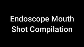 Endoscope Mouth Shot Compilation