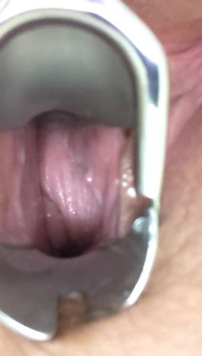 My Speculum Opens Me up