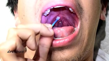 Touching the uvula with swabs