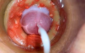 Camera Inside Deep Pussy Captures Huge Ejaculation of Sperm 4K