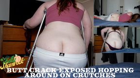 Butt Crack Exposed Hopping Around On Crutches
