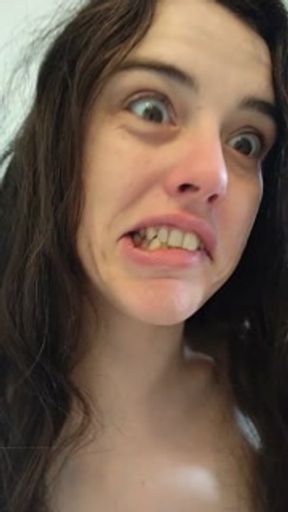 PIMPLE POPPING! Spontaneously Orgasming Crazy Camgirl PinkMoonLust Pops Pimples Face &amp; Talks Orgasm