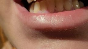 Showing my rotten teeth and tongue before brushing - progress of the tooth I lost