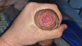 phimosis cock