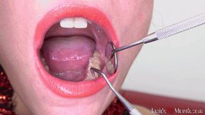 Inside My Mouth - Pauli has a dental check-up (HD)