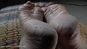 Frankie Thinks She Alone, 3rd