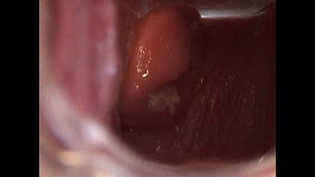 Avy Open Pussy with Speculum