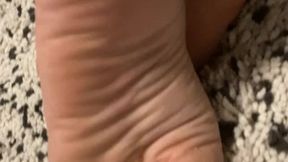 Close-up of soft, dry feet with wrinkled soles after bath