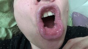 Morning bad breath and dirty tongue 2 c