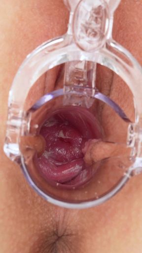 Uteruscervix, Look How I Am Inside! Extreme Close-up