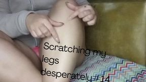 Scratching my legs desperately #14