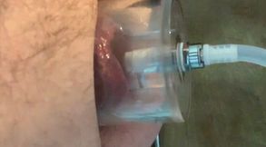 Rosebud pumping, Fucking, Fisting and nice mix of precum and piss pumped out at the end