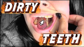 Dirty teeth