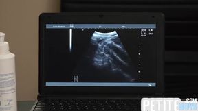 Czech Hunter And Gay Boy In Tiny Barebacked By Handsome Doctor On Ultrasound