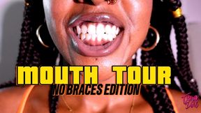 Mouth Tour - No Braces Edition