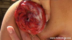 Hotkinkyjo Summer Brezee enjoys anal&#x1F44C; play &mdash;  fisting and prolapse outdoors
