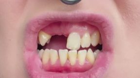 My First Teeth Tour!