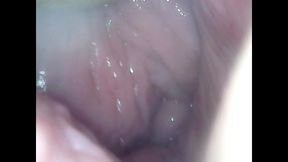 I masturbate with an endoscope in my vagina