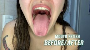 Before & After Mouth Close-Up – Uvula, Tongue & Teeth Brushing POV