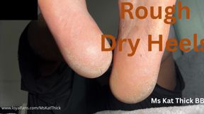 Rough Dry Heels Worship