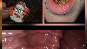 Digested By Sloane! ENDOSCOPIC SCENES