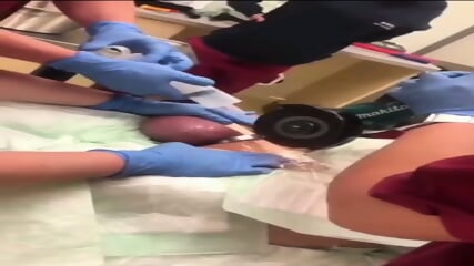 Oops! This guy accidentally got a ring stuck in his penis