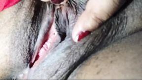 Maya's Gaping Vaginal Cleft & Rectal Orifice