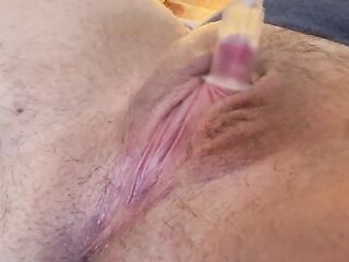 FTM clitoris pump closeup hard and stretched TBoy rod