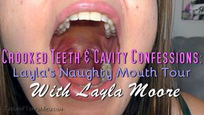 Crooked Teeth & Cavity Confessions: Layla's Naughty Mouth Tour - Layla Moore - WMV 720 HD