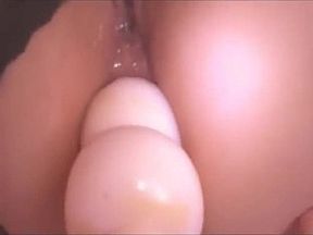 RUSSIAN HOME VIDEO. ANAL. FISTING