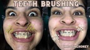 cleaning my teeth - brushing teeth