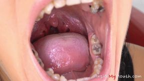 Inside My Mouth - Lexi Dona - mouth examination and exploration (FullHD)