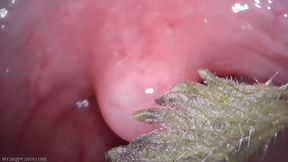 tongue and uvula stinging nettles (720 wmv)