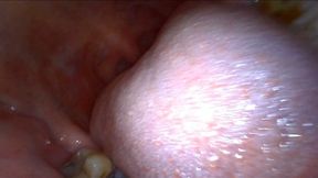 Milf Endoscopic Mouth Tour