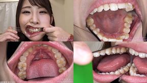 Mai - Watching Inside mouth of Japanese cute girl bite-244-1 - wmv 1080p