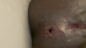 Self Anal Check