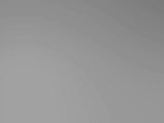 My camera captures the pont of time I get drilled