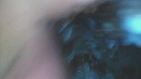Lynn Eats A Cupcake ENDOSCOPE