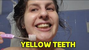 Cleaning my dirty teeth at the morning